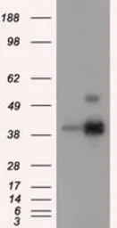 Anti-ERCC1 antibody [1B3] used in Western Blot (WB). GTX84546