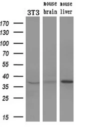 Anti-ERCC1 antibody [2A7] used in Western Blot (WB). GTX84550