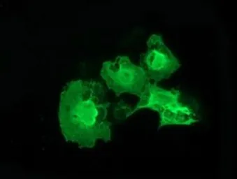 Anti-ERCC1 antibody [2A9] used in Immunocytochemistry/ Immunofluorescence (ICC/IF). GTX84555