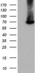 Anti-EPM2AIP1 antibody [1F11] used in Western Blot (WB). GTX84561
