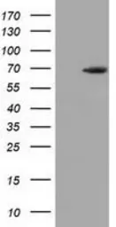 Anti-EPM2AIP1 antibody [2A5] used in Western Blot (WB). GTX84564