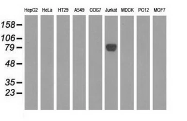 Anti-EPM2AIP1 antibody [2A5] used in Western Blot (WB). GTX84564