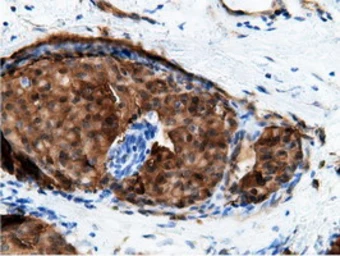 Anti-EPXH2 antibody [1H5] used in IHC (Paraffin sections) (IHC-P). GTX84569