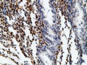 Anti-EPXH2 antibody [1H5] used in IHC (Paraffin sections) (IHC-P). GTX84569