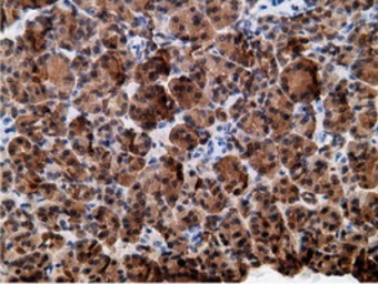 Anti-EPXH2 antibody [1H5] used in IHC (Paraffin sections) (IHC-P). GTX84569