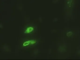 Anti-EpCAM antibody [4G10] used in Immunocytochemistry/ Immunofluorescence (ICC/IF). GTX84574