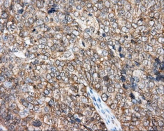 Anti-DNTTIP1 antibody [1E2] used in IHC (Paraffin sections) (IHC-P). GTX84603