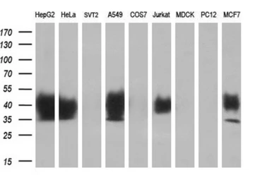 Anti-DNTTIP1 antibody [1E2] used in Western Blot (WB). GTX84603