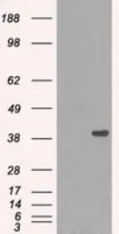 Anti-DNTTIP1 antibody [1E2] used in Western Blot (WB). GTX84603