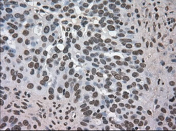 Anti-DHFR antibody [3A11] used in IHC (Paraffin sections) (IHC-P). GTX84618