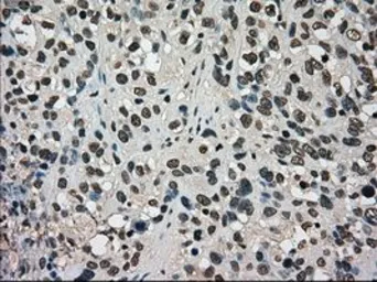 Anti-DHFR antibody [3A11] used in IHC (Paraffin sections) (IHC-P). GTX84618