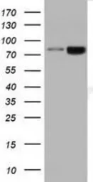 Anti-DGKB antibody [1F9] used in Western Blot (WB). GTX84619