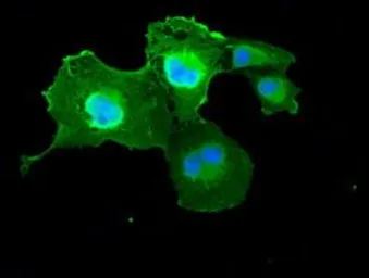 Anti-ICAD antibody [5C4] used in Immunocytochemistry/ Immunofluorescence (ICC/IF). GTX84621