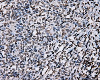 Anti-DAP Kinase 2 antibody [1C5] used in IHC (Paraffin sections) (IHC-P). GTX84631