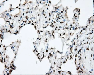 Anti-DAP Kinase 2 antibody [1C5] used in IHC (Paraffin sections) (IHC-P). GTX84631