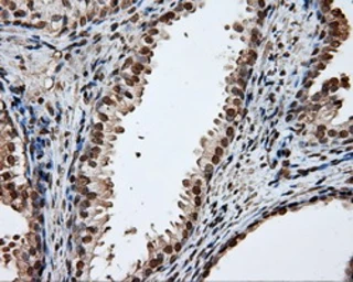 Anti-DAP Kinase 2 antibody [1C5] used in IHC (Paraffin sections) (IHC-P). GTX84631