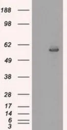 Anti-CYP2E1 antibody [5F11] used in Western Blot (WB). GTX84634