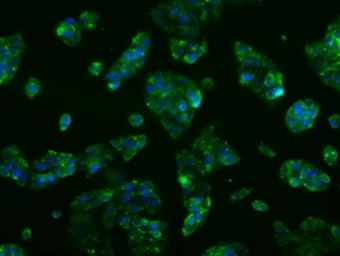 Anti-CYP2E1 antibody [9E6] used in Immunocytochemistry/ Immunofluorescence (ICC/IF). GTX84635