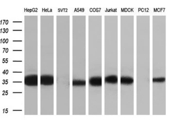 Anti-CYB5R3 antibody [1E3] used in Western Blot (WB). GTX84645