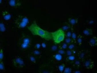 Anti-CRYM antibody [1G7] used in Immunocytochemistry/ Immunofluorescence (ICC/IF). GTX84654