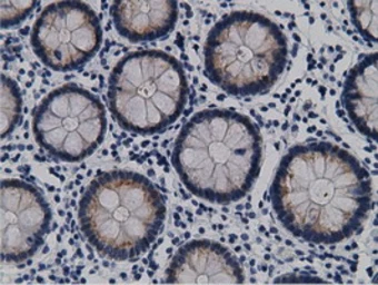 Anti-CRYM antibody [1G7] used in IHC (Paraffin sections) (IHC-P). GTX84654