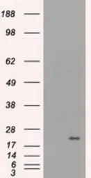Anti-alpha B Crystallin antibody [6D11] used in Western Blot (WB). GTX84657