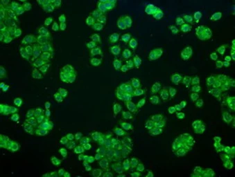 Anti-alpha B Crystallin antibody [6A9] used in Immunocytochemistry/ Immunofluorescence (ICC/IF). GTX84659