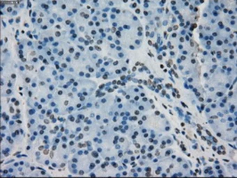 Anti-alpha B Crystallin antibody [6A9] used in IHC (Paraffin sections) (IHC-P). GTX84659
