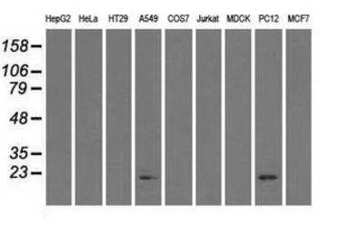 Anti-alpha B Crystallin antibody [6A9] used in Western Blot (WB). GTX84659