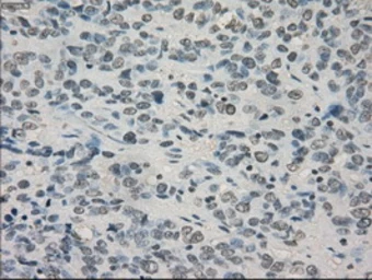 Anti-alpha B Crystallin antibody [3C2] used in IHC (Paraffin sections) (IHC-P). GTX84661