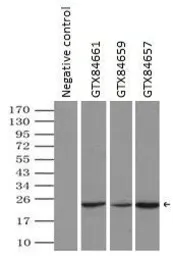Anti-alpha B Crystallin antibody [3C2] used in Immunoprecipitation (IP). GTX84661
