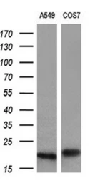 Anti-alpha B Crystallin antibody [3C2] used in Western Blot (WB). GTX84661