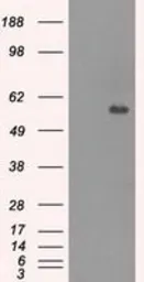 Anti-CNDP1 antibody [2F8] used in Western Blot (WB). GTX84677