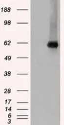 Anti-Chk2 antibody [2F4] used in Western Blot (WB). GTX84685