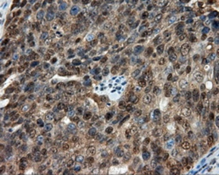 Anti-CUGBP1 antibody [5B8] used in IHC (Paraffin sections) (IHC-P). GTX84692