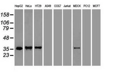 Anti-CDX2 antibody [1A3] used in Western Blot (WB). GTX84694