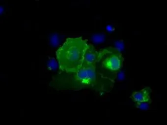 Anti-CD5 antibody [7A7] used in Immunocytochemistry/ Immunofluorescence (ICC/IF). GTX84709