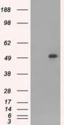 Anti-CD4 antibody [9G7] used in Western Blot (WB). GTX84713