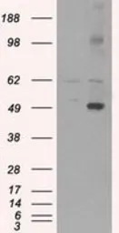 Anti-CD4 antibody [18E3] used in Western Blot (WB). GTX84714