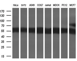 Anti-CD36 antibody [4H7] used in Western Blot (WB). GTX84722
