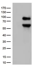 Anti-CD36 antibody [4H7] used in Western Blot (WB). GTX84722
