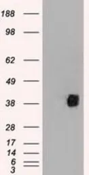 Anti-CD2 antibody [9D1] used in Western Blot (WB). GTX84725