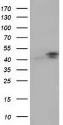 Anti-CBWD1 antibody [2D2] used in Western Blot (WB). GTX84727