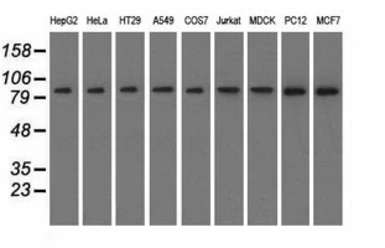 Anti-C17orf28 antibody [2F4] used in Western Blot (WB). GTX84750
