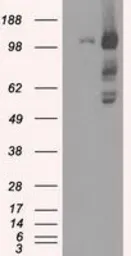 Anti-BUB1B antibody [11G2] used in Western Blot (WB). GTX84768