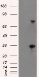 Anti-BTN3A2 antibody [1A6] used in Western Blot (WB). GTX84773