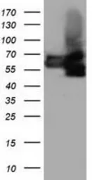 Anti-BTN1A1 antibody [3A12] used in Western Blot (WB). GTX84780