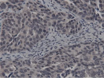 Anti-BTN1A1 antibody [7B5] used in IHC (Paraffin sections) (IHC-P). GTX84781