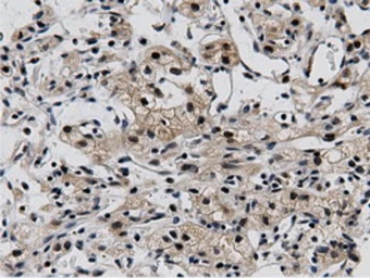 Anti-BTN1A1 antibody [7B5] used in IHC (Paraffin sections) (IHC-P). GTX84781
