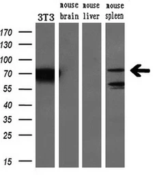 Anti-BTK antibody [10E10] used in Western Blot (WB). GTX84785